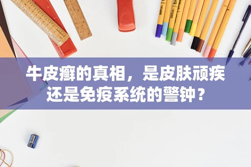 牛皮癣的真相，是皮肤顽疾还是免疫系统的警钟？