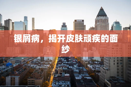 银屑病，揭开皮肤顽疾的面纱