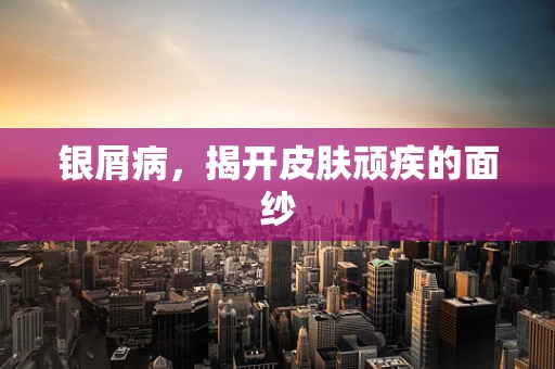 银屑病，揭开皮肤顽疾的面纱